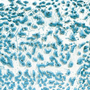 CR22 Speckled Teal